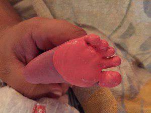 md painted foot